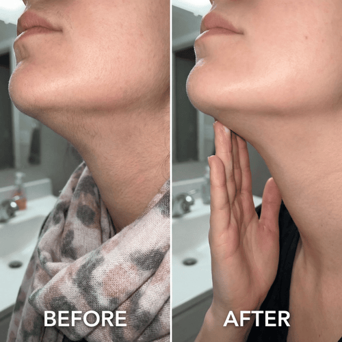 Cyperus Oil Rotundus