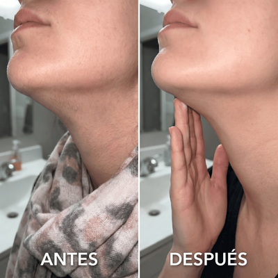 Aceite Inhibidor de Vello Cyperus Rotundus